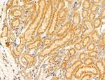GUCY1A2 Antibody in Immunohistochemistry (Paraffin) (IHC (P))