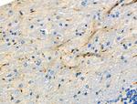 HAPLN1 Polyclonal Antibody