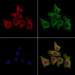 USH1C Polyclonal Antibody