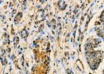 HAX1 Polyclonal Antibody