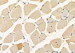 HAX1 Antibody in Immunohistochemistry (Paraffin) (IHC (P))