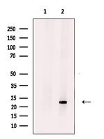HBEGF Polyclonal Antibody