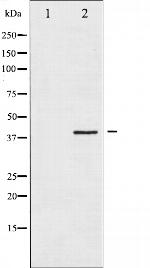 HDAC8 Polyclonal Antibody
