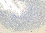 HECW1 Polyclonal Antibody