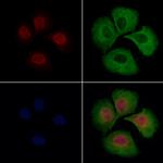 KIAA1794 Antibody in Immunocytochemistry (ICC/IF)