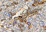 HGF Antibody in Immunohistochemistry (Paraffin) (IHC (P))