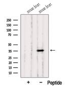 HIBADH Antibody in Western Blot (WB)