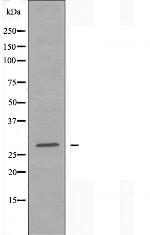 HINT1 Polyclonal Antibody