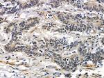 HIPK1 Polyclonal Antibody