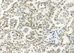 HKR1 Polyclonal Antibody