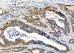 HLA-ABC Antibody in Immunohistochemistry (Paraffin) (IHC (P))