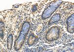 HLA-ABC Antibody in Immunohistochemistry (Paraffin) (IHC (P))