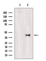 HLA-ABC Antibody in Western Blot (WB)