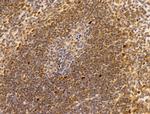 HMGA1 Polyclonal Antibody