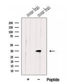HMGCL Polyclonal Antibody