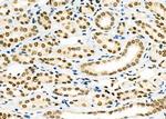 PCBP1 Polyclonal Antibody