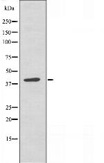 RBMX Polyclonal Antibody