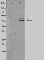 hnRNP M Polyclonal Antibody