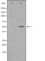 hnRNP K Antibody in Western Blot (WB)
