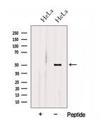 HOXA10 Polyclonal Antibody