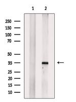 HOXA4 Antibody in Western Blot (WB)