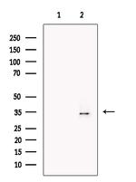 HOXA4 Antibody in Western Blot (WB)
