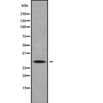 HOXC9 Antibody in Western Blot (WB)