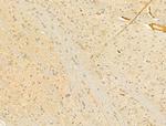 HPS3 Antibody in Immunohistochemistry (Paraffin) (IHC (P))