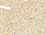 HPS3 Polyclonal Antibody