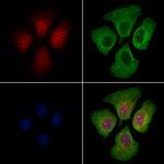 HSP20 Polyclonal Antibody