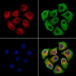 HAS2 Polyclonal Antibody