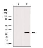 IGFBP4 Polyclonal Antibody
