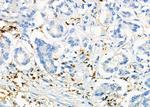 ICOS (CD278) Polyclonal Antibody