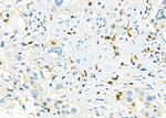 ICOS (CD278) Antibody in Immunohistochemistry (Paraffin) (IHC (P))