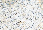 ICOS (CD278) Antibody in Immunohistochemistry (Paraffin) (IHC (P))