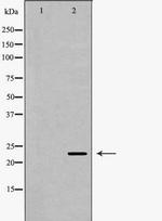 ICOS (CD278) Antibody in Western Blot (WB)