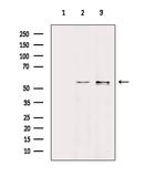 Human IgA Antibody in Western Blot (WB)