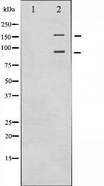 IR/IGF1R Polyclonal Antibody