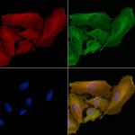 IGFBP6 Polyclonal Antibody