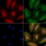 Ihh Polyclonal Antibody