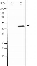 IL10RA Polyclonal Antibody