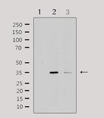 IL20RB Polyclonal Antibody