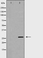 IL-27 p28 Polyclonal Antibody