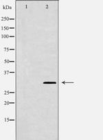 CD4/CD25 Antibody in Western Blot (WB)
