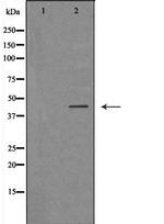 IL2RG Polyclonal Antibody