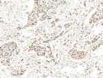 ILF1 Antibody in Immunohistochemistry (Paraffin) (IHC (P))