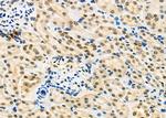 ILF3 Antibody in Immunohistochemistry (Paraffin) (IHC (P))