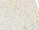 ITGA5 Polyclonal Antibody