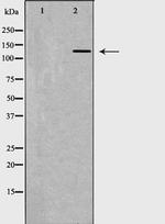 CD11a Antibody in Western Blot (WB)