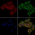 CSNK1A1L Polyclonal Antibody